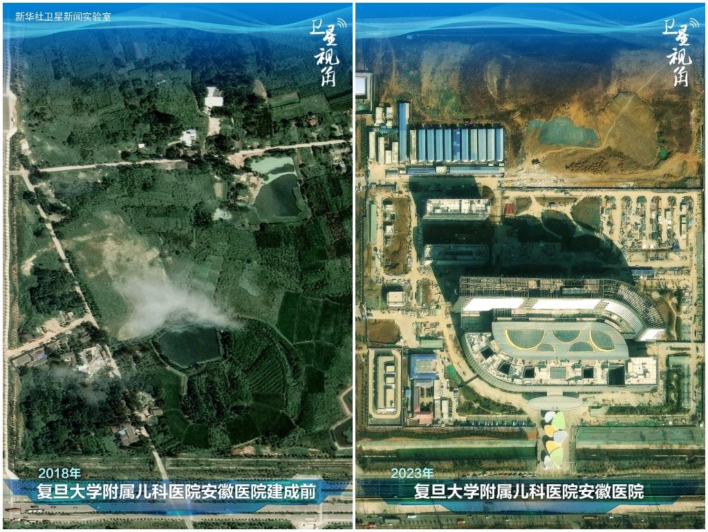 2023年與2018年相比，復(fù)旦大學(xué)附屬兒科醫(yī)院安徽醫(yī)院從一片荒地到建成投用。該項(xiàng)目是安徽省在長三角一體化高質(zhì)量發(fā)展衛(wèi)生健康領(lǐng)域的重大項(xiàng)目，也是安徽首批落地的國家區(qū)域醫(yī)療中心。